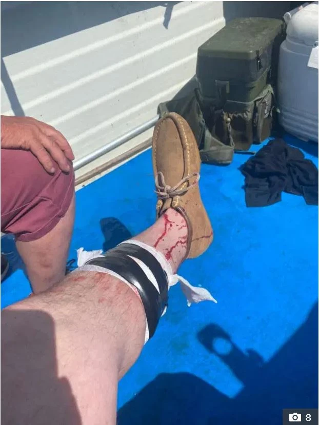 Yanlışlıkla teknesine çekti köpekbalığı saldırısına uğradı!